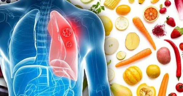Ung thư phổi nên ăn gì